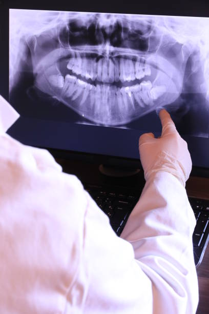 Best Emergency Tooth Extraction in Brent, AL